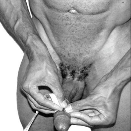 Ukur sirit sateuacan pengawét